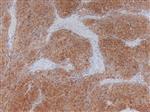 3170B | Control Slides:Immunopathology; CD117, c-Kit